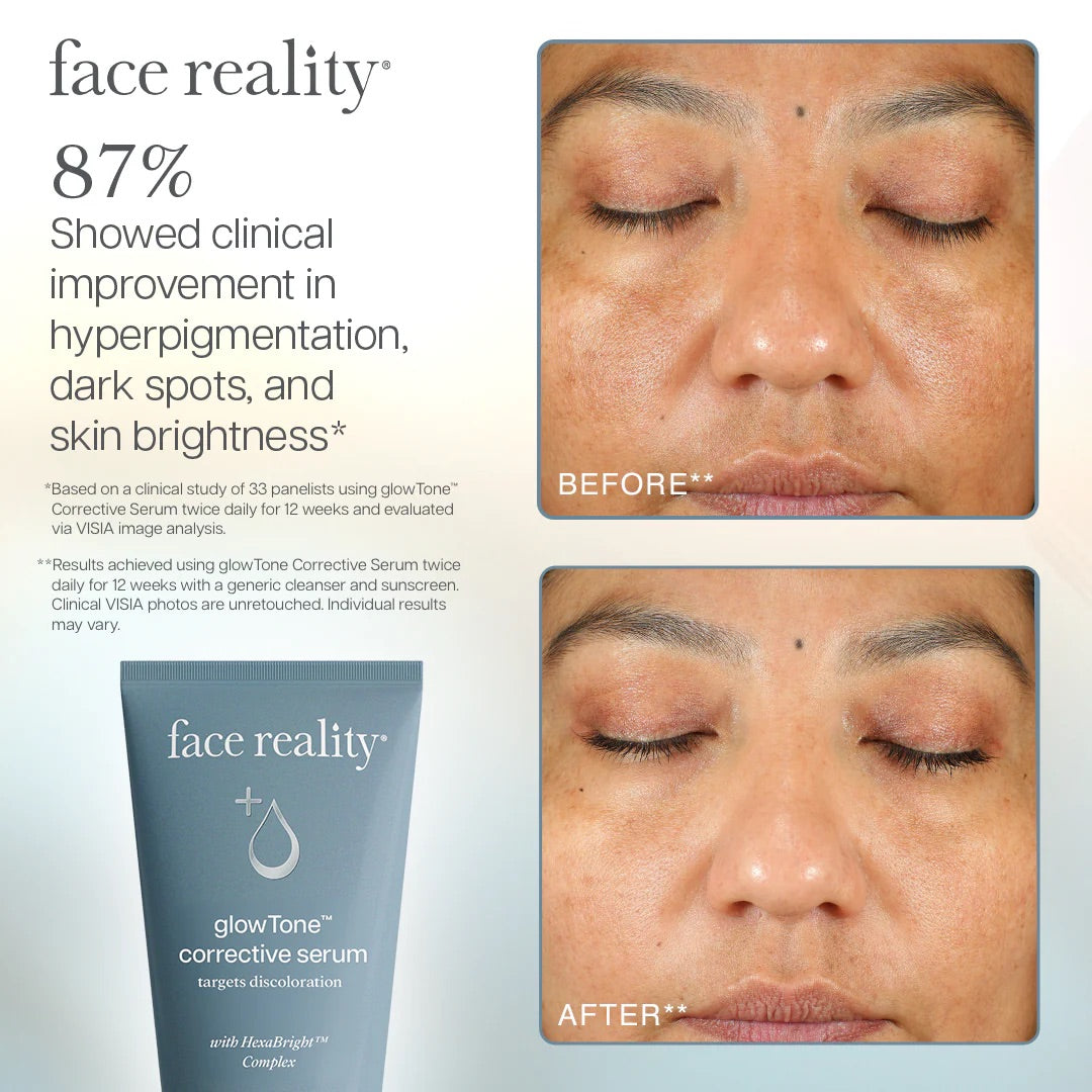 Face Reality's glowTone corrective serum infographic with before and after photos of skin